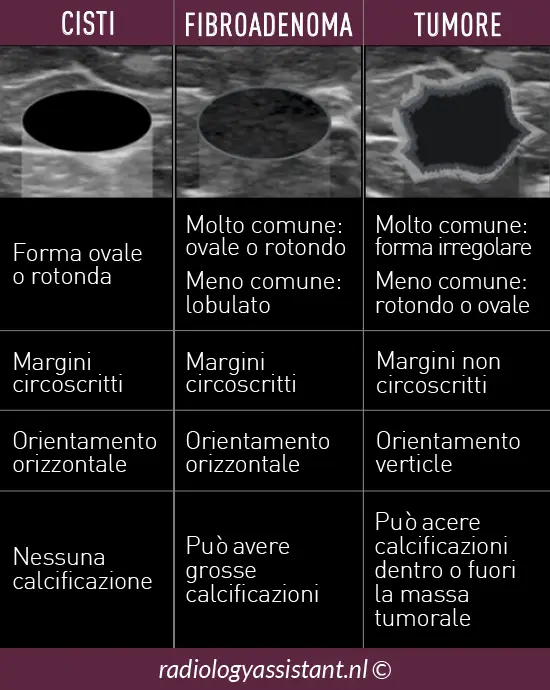 Come appaiono i noduli in ecografia