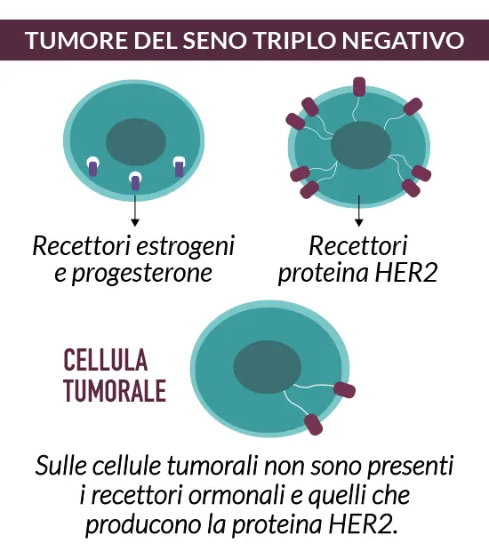 Cosa vuol dire tumore del seno Triplo negativo