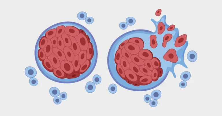 Emocromo quali valori sono spia di un tumore