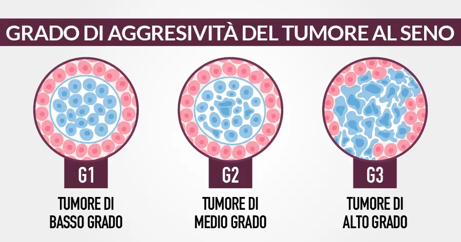 Grado di aggressività del tumore al seno