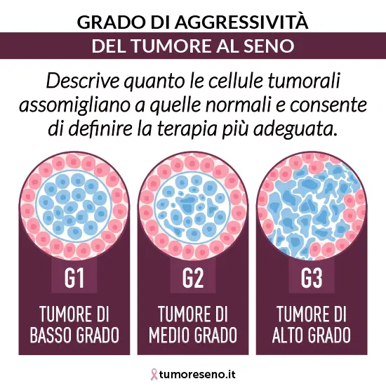 Grado di aggressività del tumore al seno