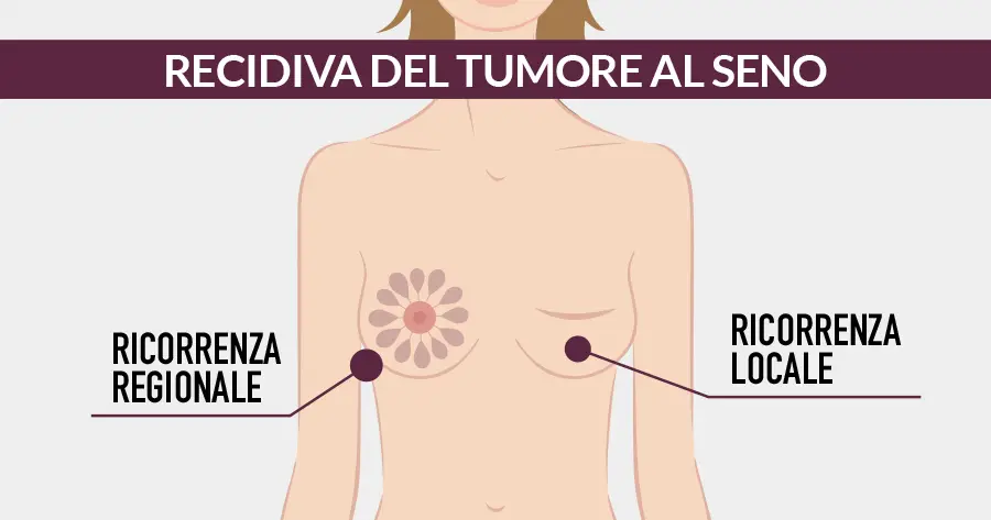 Recidiva tumore al seno