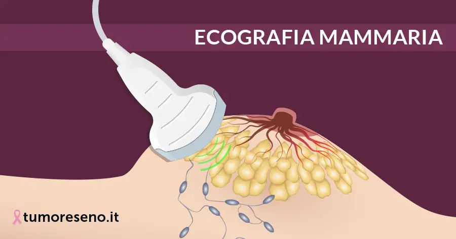 ecografia mammaria