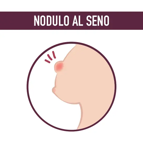 nodulo al seno