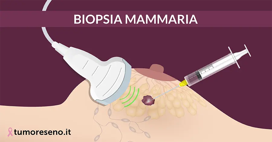 biopsia del seno