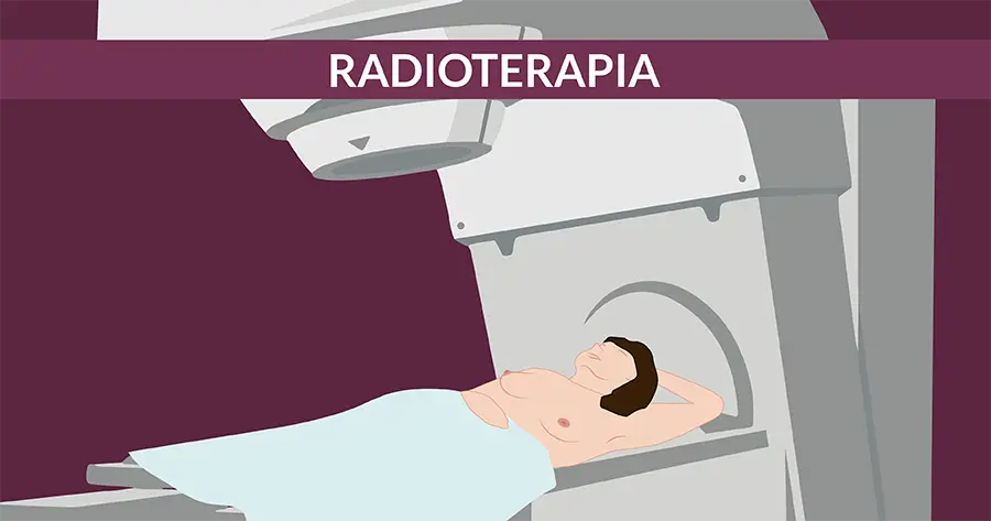 radioterapia per il tumore al seno