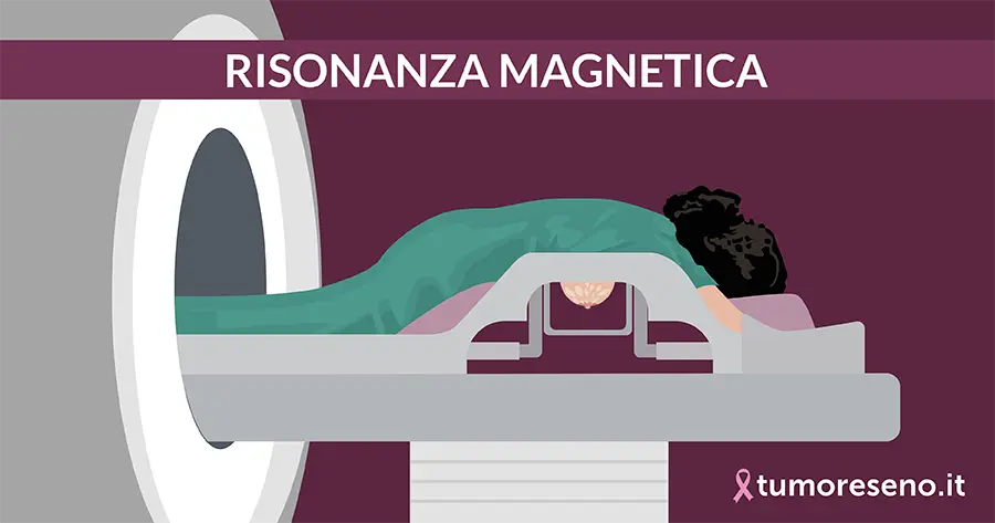 risonanza magnetica del seno