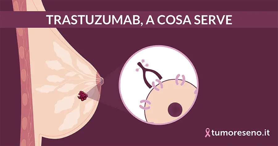 trastuzumab nella cura del tumore al seno